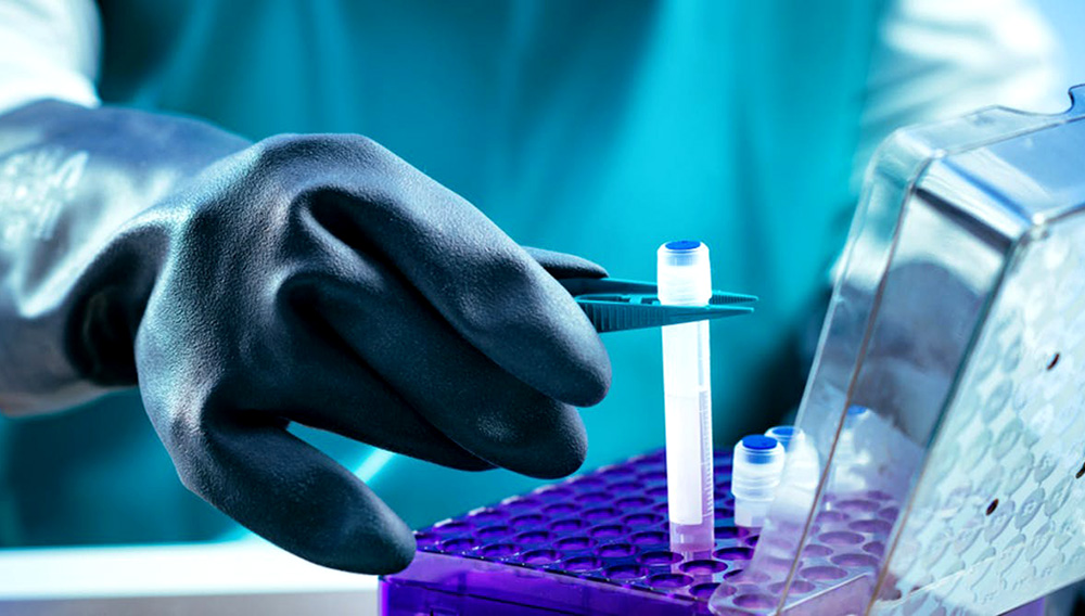 Biobanks can help scientists retain quality samples for future experiments. Microgen/Shutterstock