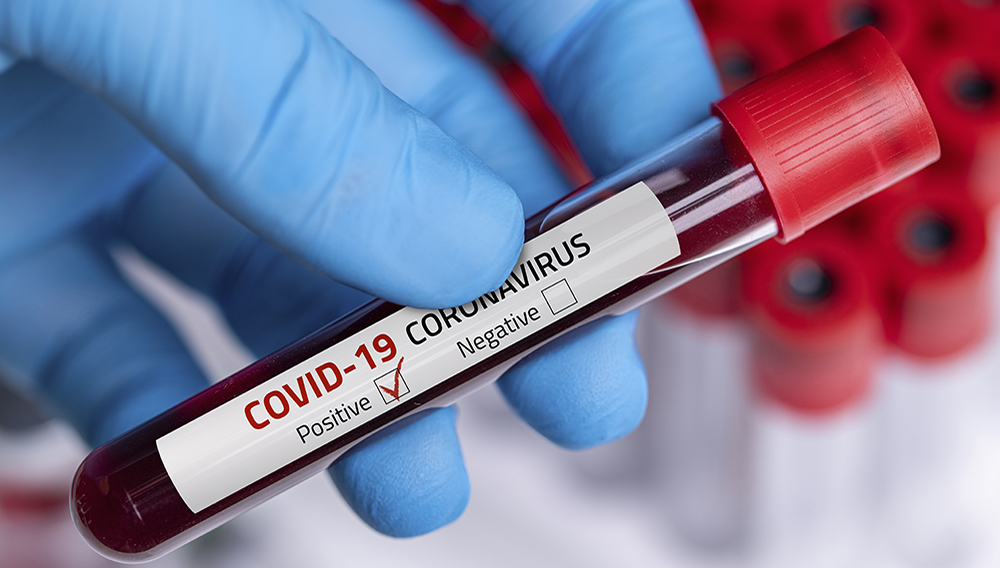 Coronavirus 2019-nCoV Blood Sample. Corona virus outbreaking. Epidemic virus Respiratory Syndrome.