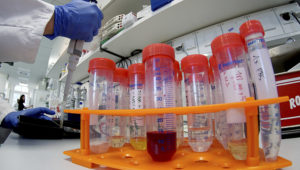 A lab assistant works on samples after an AP interview with Christian Drosten, director of the institute for virology of Berlin's Charite hospital on his researches on the coronavirus in Berlin, Germany, Tuesday, Jan. 21, 2020. (AP Photo/Michael Sohn)